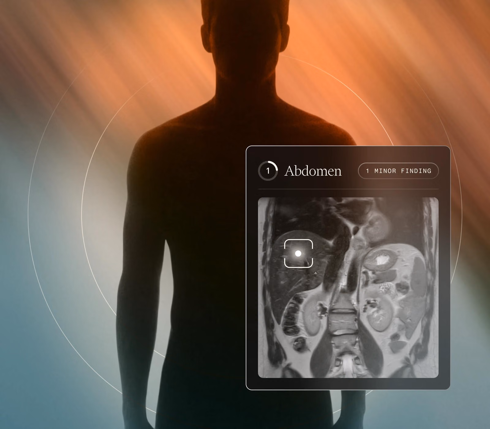 Male silhouette on a warm gradient background with an overlaid card displaying a prostate MRI and follow-up status.